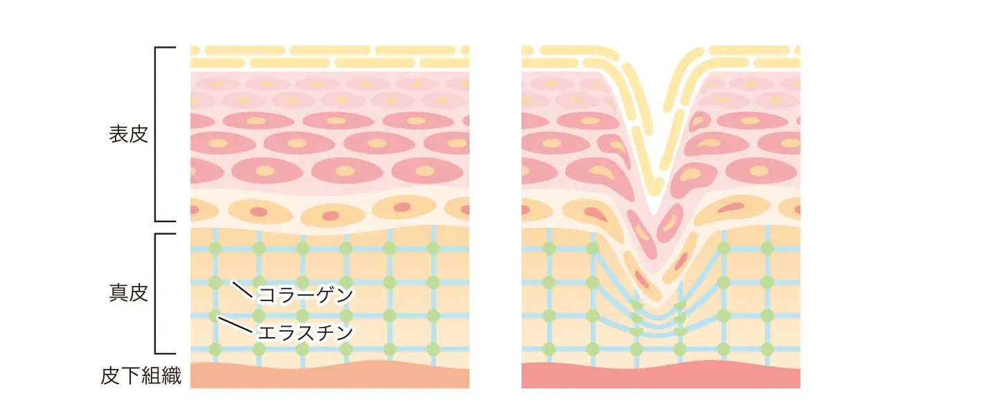 たるみ・ハリ感アップにお悩みの方